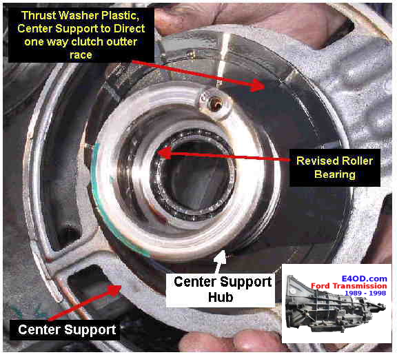 center support removing4